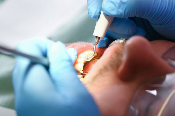 Best Emergency Dental Services for Seniors in Wilsons Mills, NC