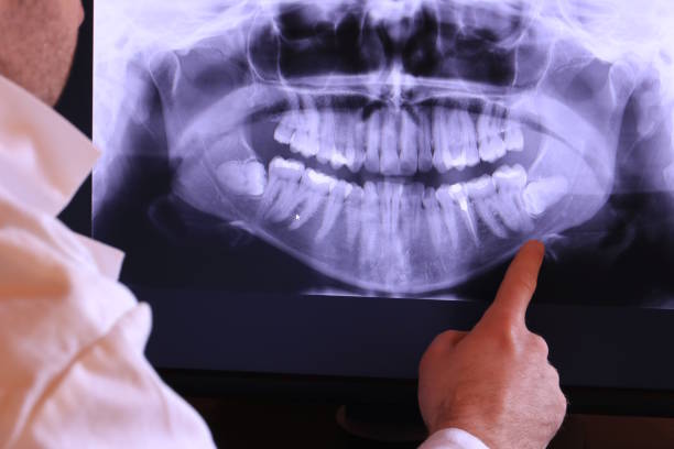 Best 24-Hour Emergency Dentist in Wilsons Mills, NC