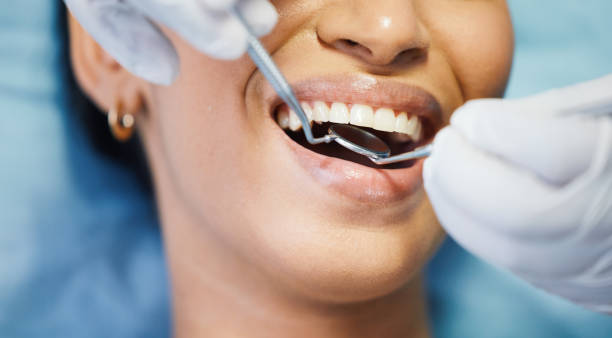 Best Emergency Dental Extractions in Wilsons Mills, NC